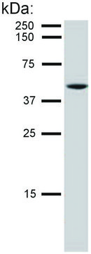 Monoclonal Anti-Cytokeratin 8 antibody produced
