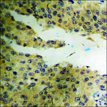 Anti-phospho-Vimentin (pSer??) antibody produced in