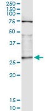 Monoclonal Anti-OTUB2 antibody produced in