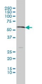 Monoclonal Anti-SLC18A1 antibody produced in