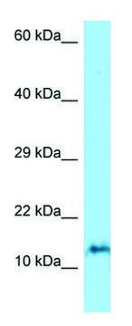 Anti-ORMDL3 (N-terminal) antibody produced in