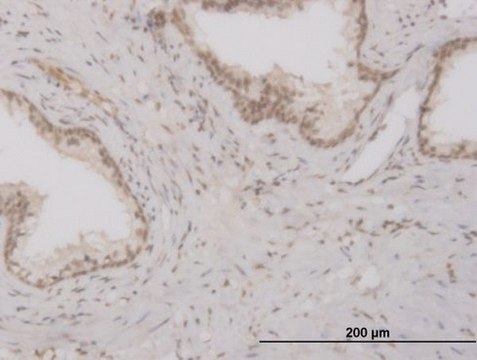 ANTI-FOXO3A antibody produced in mouse