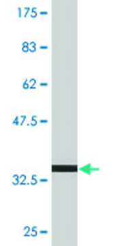 Monoclonal Anti-TPD52 antibody produced in