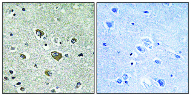 Anti-ZDHHC9 antibody produced in rabbit