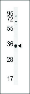 ANTI-ECAT1(N-TERMINAL) antibody produced in rabbit