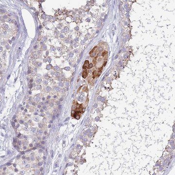 Anti-PDHA1 antibody produced in rabbit