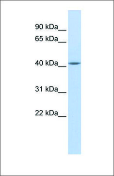 Anti-EPSTI1 antibody produced in rabbit