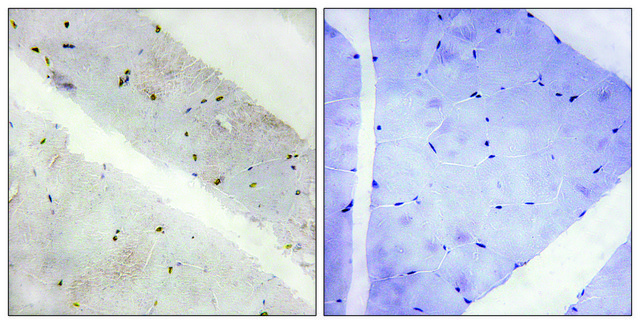 Anti-LATS2 antibody produced in rabbit