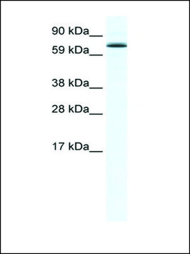 Anti-FOXO6 antibody produced in rabbit