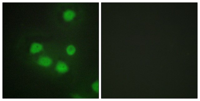 Anti-SIX6 antibody produced in rabbit