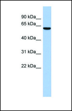 Anti-LEMD2 antibody produced in rabbit