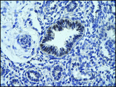 Anti-RCOR1 antibody produced in rabbit