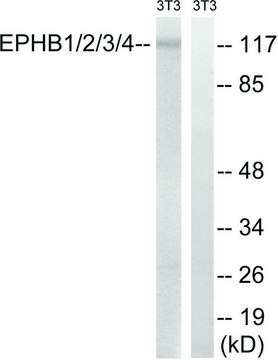Anti-EPHB1 antibody produced in rabbit