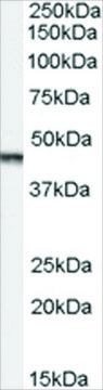 Anti-Aurora Kinase A/AURKA antibody produced