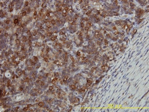 Monoclonal Anti-CCT5 antibody produced in