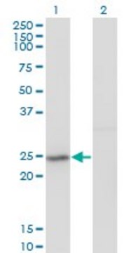 Monoclonal Anti-PFS2, (N-terminal) antibody produced