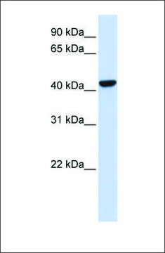 Anti-CTH antibody produced in rabbit