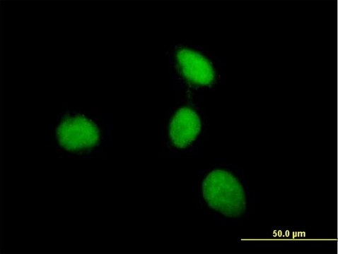Anti-MEN1 antibody produced in mouse