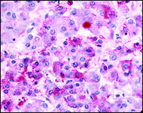 Anti-GPR152/PGR5 (AB2) antibody produced in