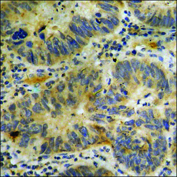Anti-phospho-p300 (pSer??) antibody produced in