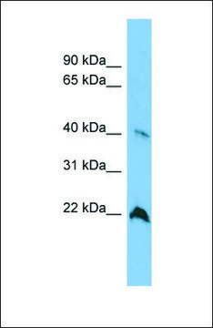 Anti-TGDS antibody produced in rabbit