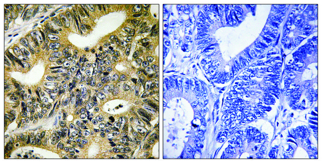 Anti-phospho-4E-BP1 (pThr??) antibody produced in