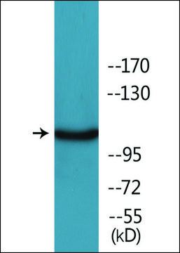 Anti-phospho-KIT (pTyr??³) antibody produced in