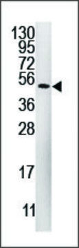 Anti-FASTK (center) antibody produced in