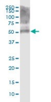 ANTI-KRT39 antibody produced in mouse