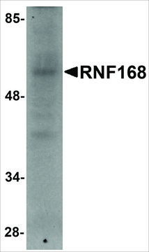 Anti-RNF168 antibody produced in rabbit