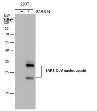 Monoclonal Anti-SARS-CoV Nucleocapsid antibody produced