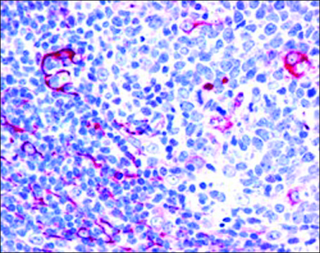 Anti-NET1/ARHGEF8, C-Terminal antibody produced in