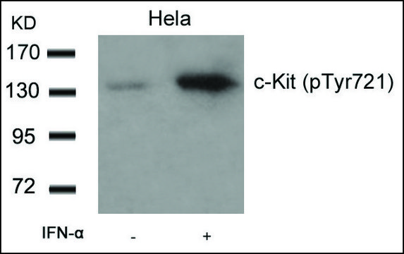 Anti-phospho-KIT (pTyr?²¹) antibody produced in