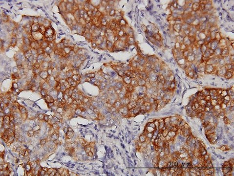 Monoclonal Anti-EIF4G3 antibody produced in