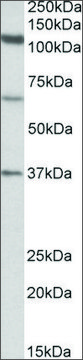 Anti-CP110 (N-terminal) antibody produced in