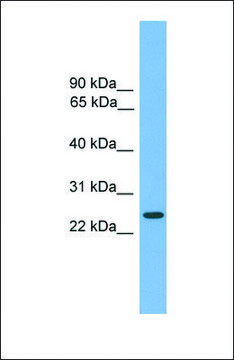 Anti-CHMP4B antibody produced in rabbit