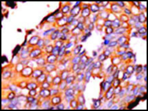 Anti-RFK (N-term) antibody produced in