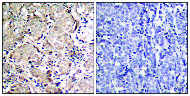 Anti-phospho-FOXO1 (pSer³¹?) antibody produced in
