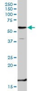 Anti-TNFRSF1B antibody produced in rabbit