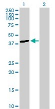 Anti-ALDOB antibody produced in rabbit