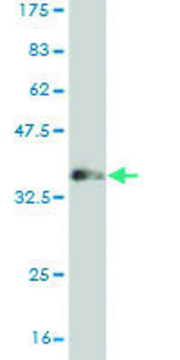 Monoclonal Anti-MUSK antibody produced in