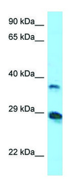Anti-VSIG4 (N-terminal) antibody produced in