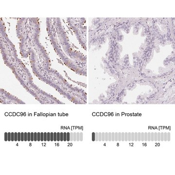 Anti-CCDC96 antibody produced in rabbit