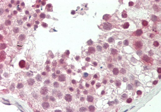 Anti-RARG antibody produced in rabbit