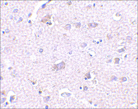 Anti-CDNF (ab1) antibody produced in
