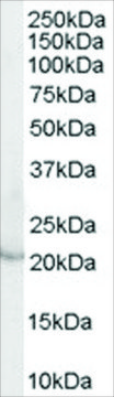 Anti-Lipocalin 2/NGAL (AB1) antibody produced