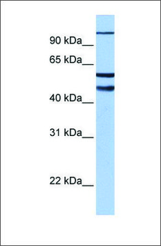 Anti-EZH1 antibody produced in rabbit