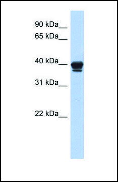 Anti-NAPE-PLD, (N-terminal) antibody produced in