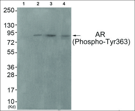 Anti-phospho-Androgen Receptor (pTyr³?³) antibody produced