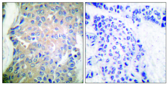 Anti-CPI17 ? antibody produced in